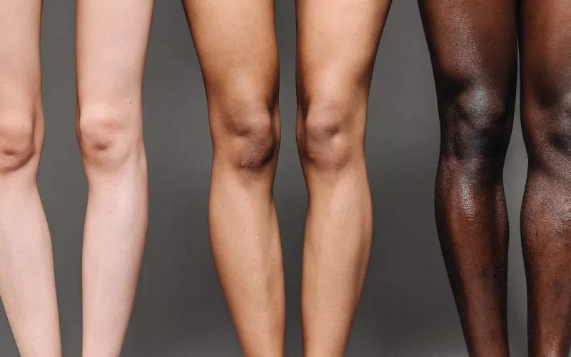 A side-by-side comparison of four pairs of knees and lower legs, showcasing a range of skin tones from light to dark, against a gray background.