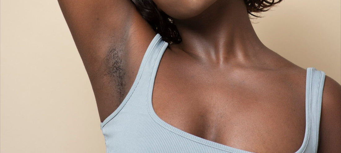 Underarm Pigmentation Migration: Why It Happens & How to Prevent It