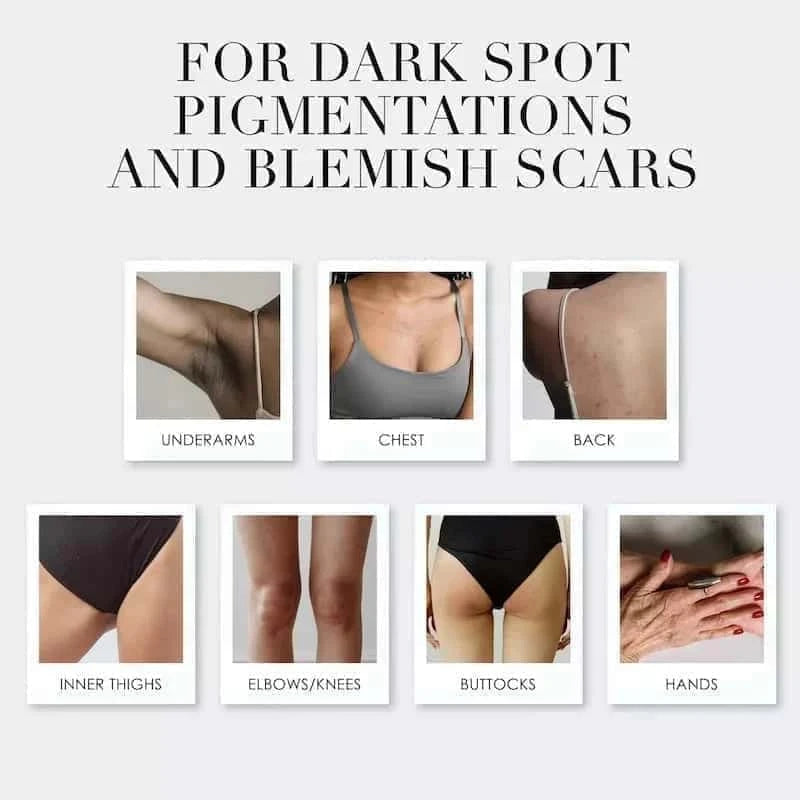 THE KOJIC ACID BRIGHTENING BAR